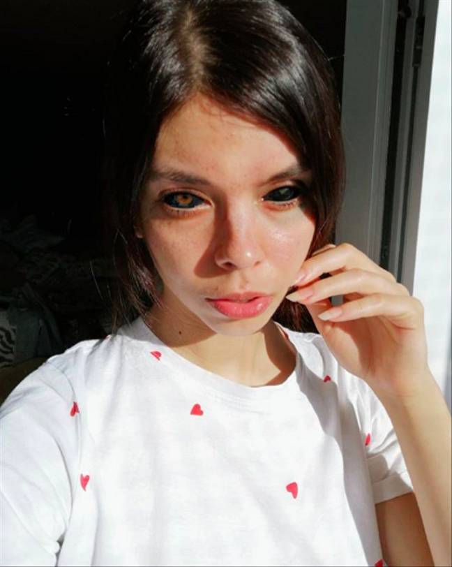 a girl in white shirt with damaged eyes to show harms of eye tattoo