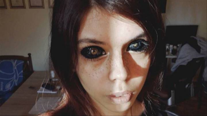 a girl with damaged eyes after botched eye tattoo procedure and showing harms of eye tattoo